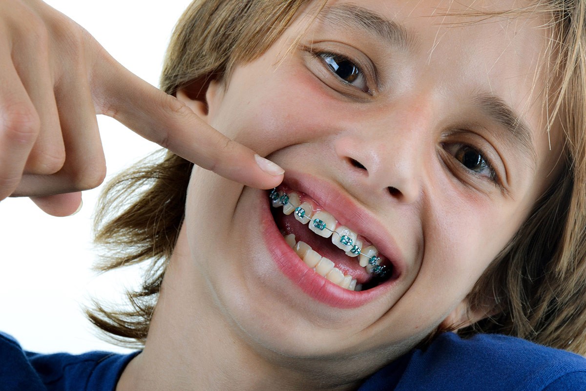 Лечение на зъби при деца от 3 до 18 години